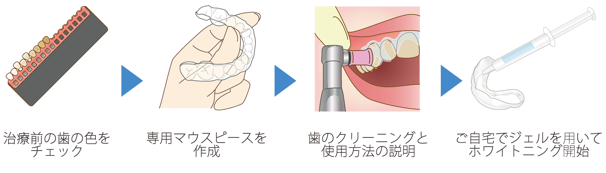 ホームホワイトニング