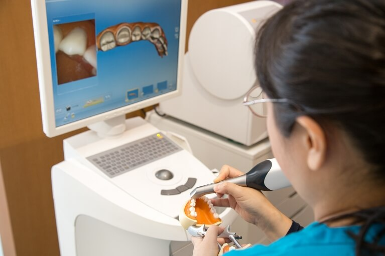 セレック治療｜つつみ歯科医院